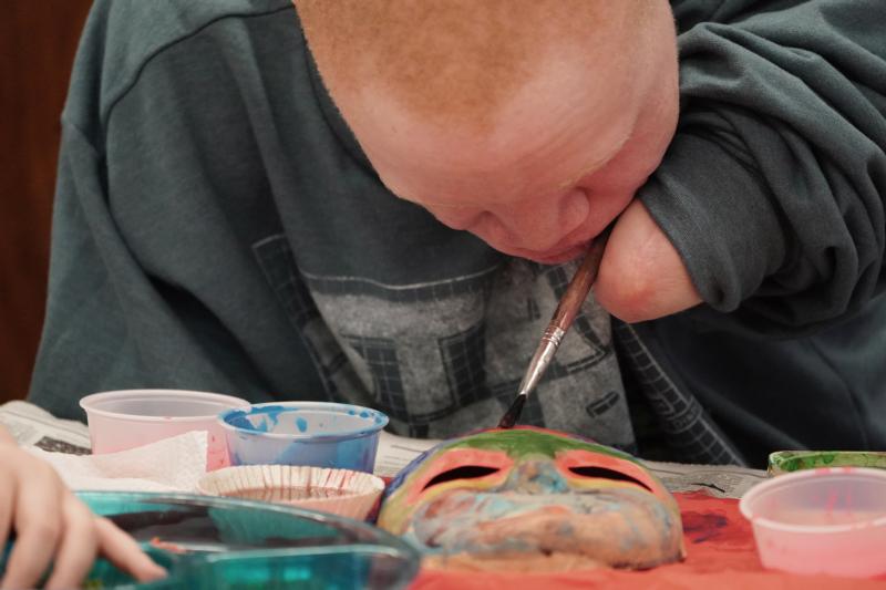 African bishop: Church must work to end violence against albinos