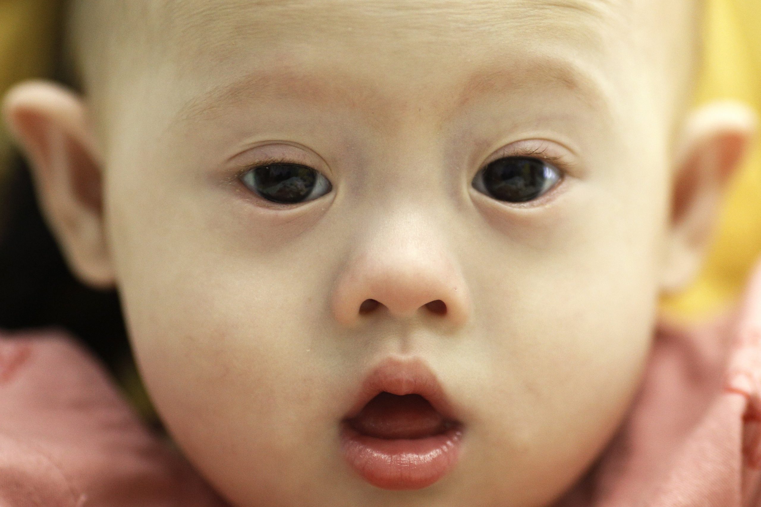 Federal appeals court says Ohio can enforce Down syndrome abortion law