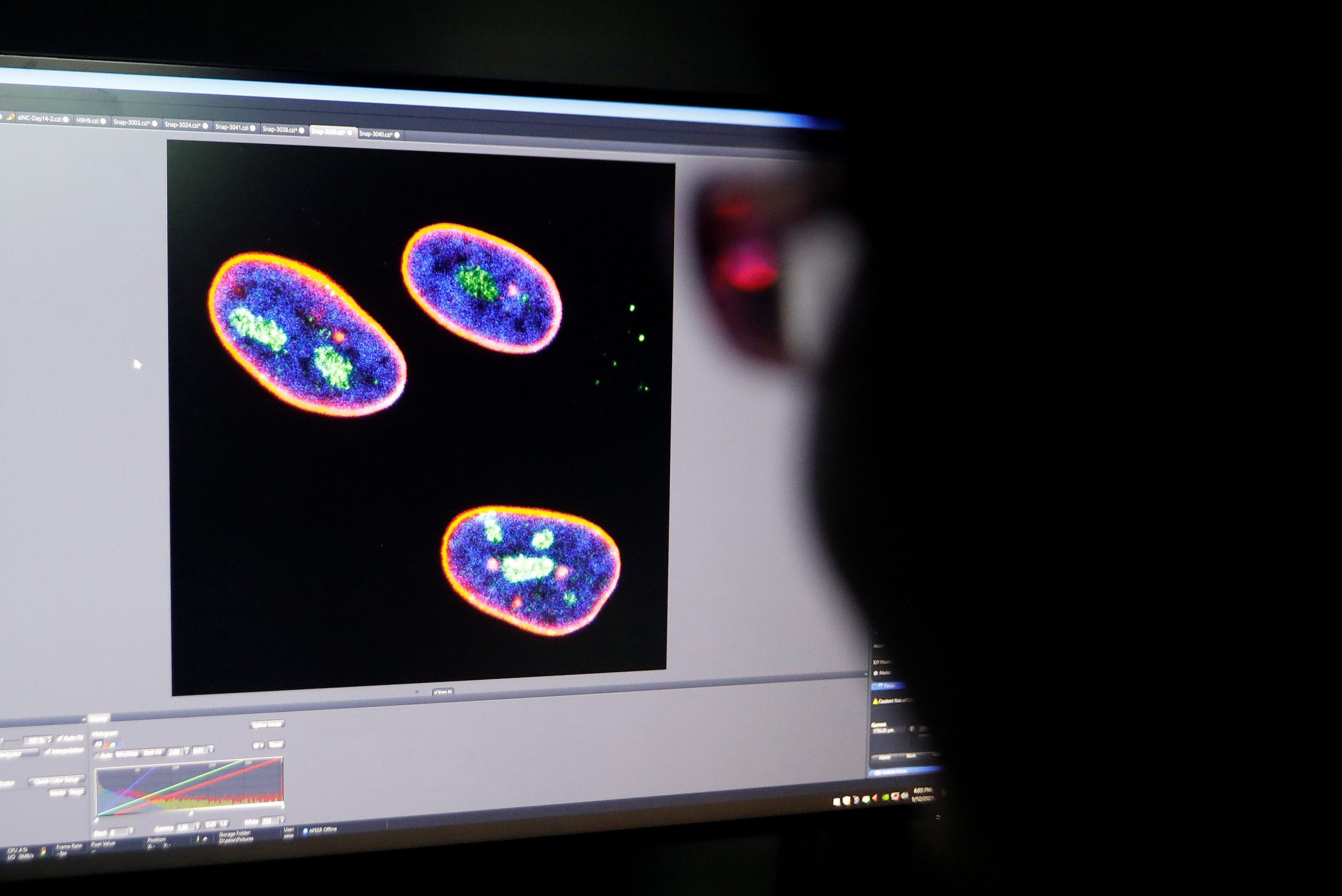 Canadian ethicists question plan to end limits on culturing human embryos