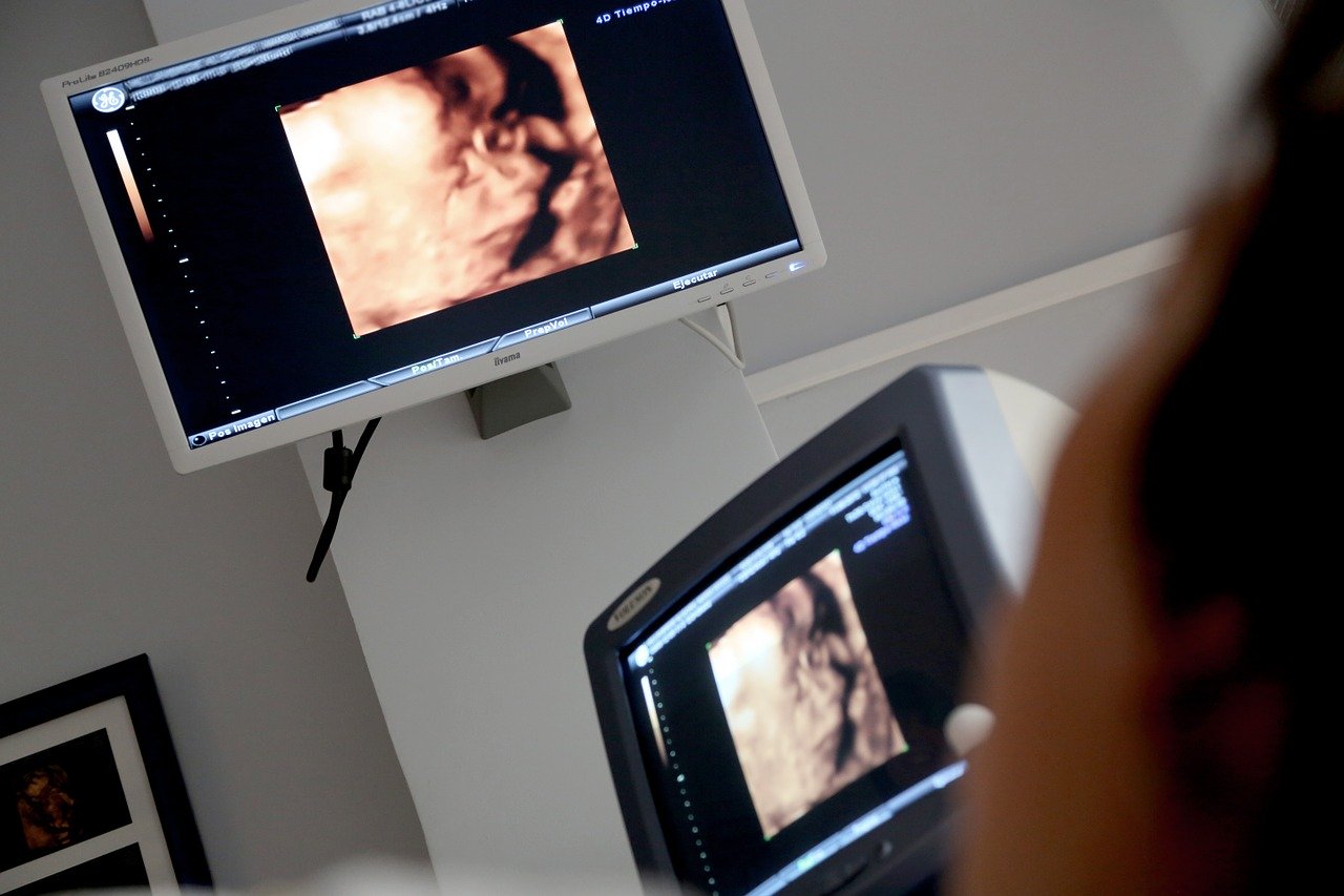 Catholic Church: Abortion statistics in Scotland ‘deeply depressing’