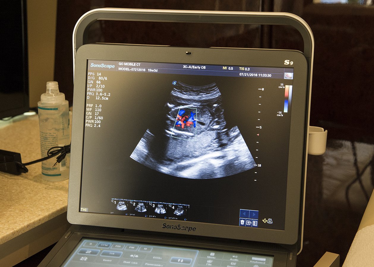 Doctors: Advances since Roe confirm abortion ‘takes life of unborn child’