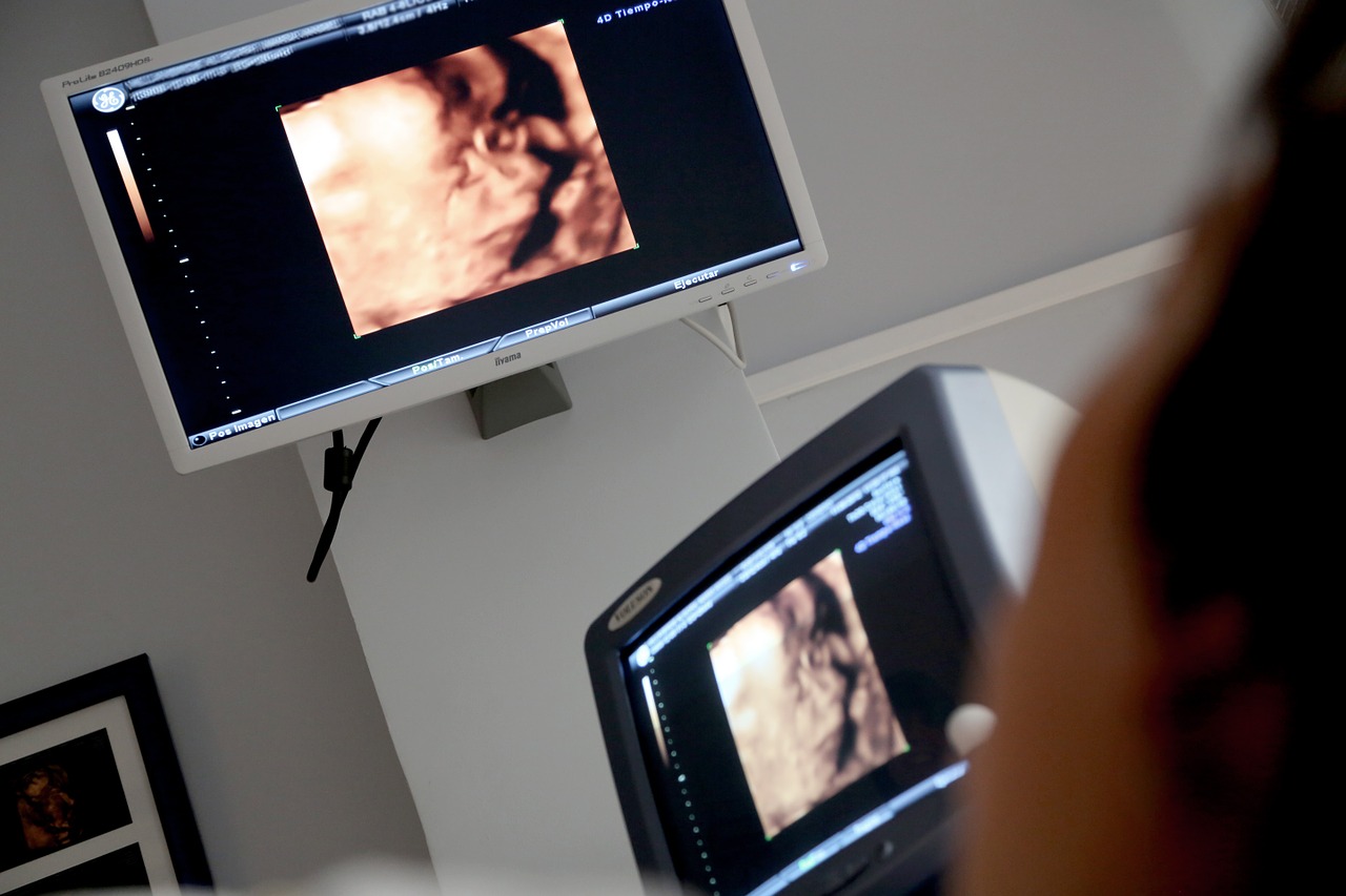 UK pro-life leaders welcome end of ‘DIY home abortions’ in England
